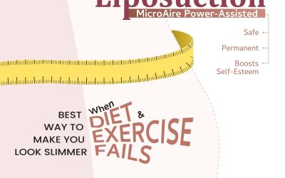When Diet & Exercise Fails