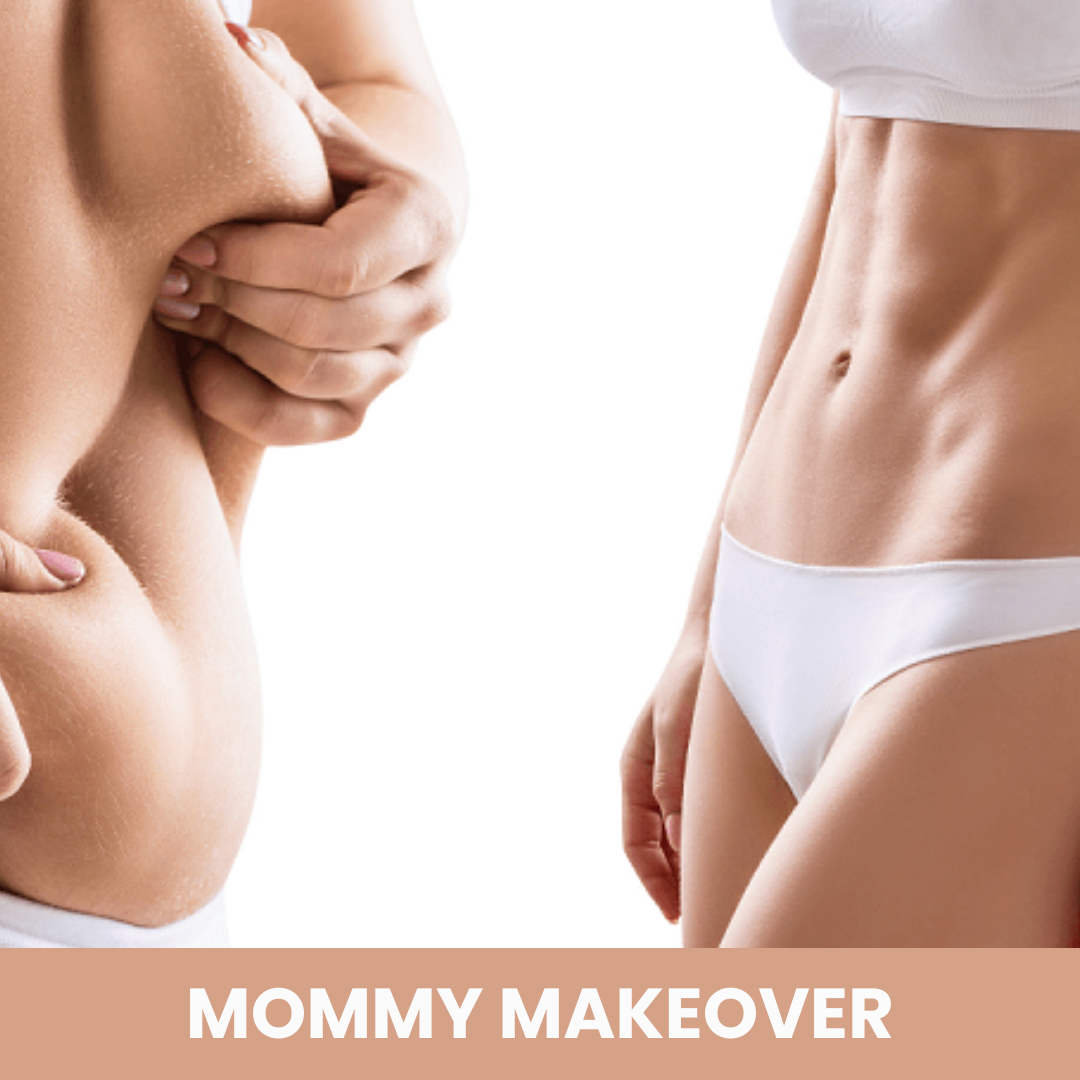 Mommy-Makeover