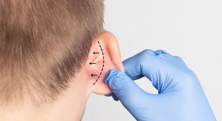 best ear reconstruction surgeon in india