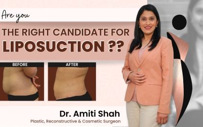 Are you the right candidate for Liposuction Surgery? Remove Unwanted Body Fat