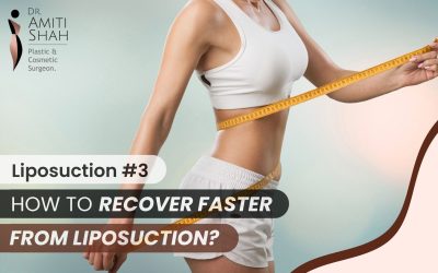 How to Recover Faster from Liposuction?