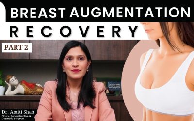 Recovery after Breast Augmentation Surgery: What to Expect