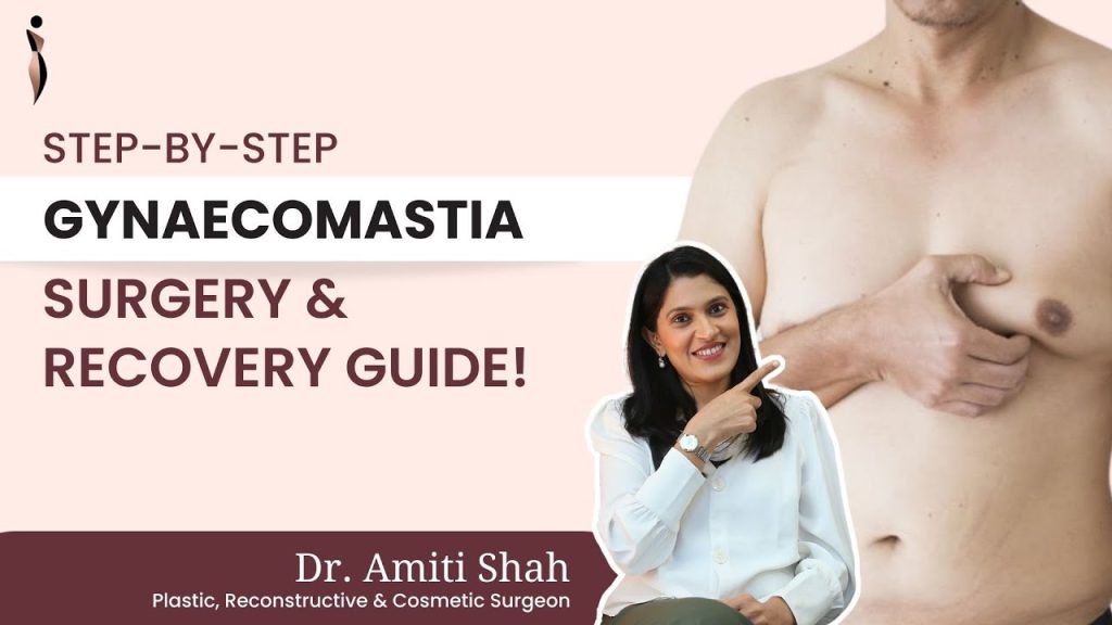 Step by Step Gynaecomastia Surgery & Recovery Guide
