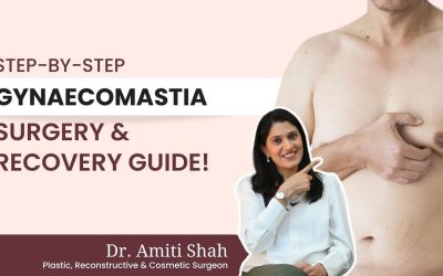 Step by Step Gynaecomastia Surgery & Recovery Guide