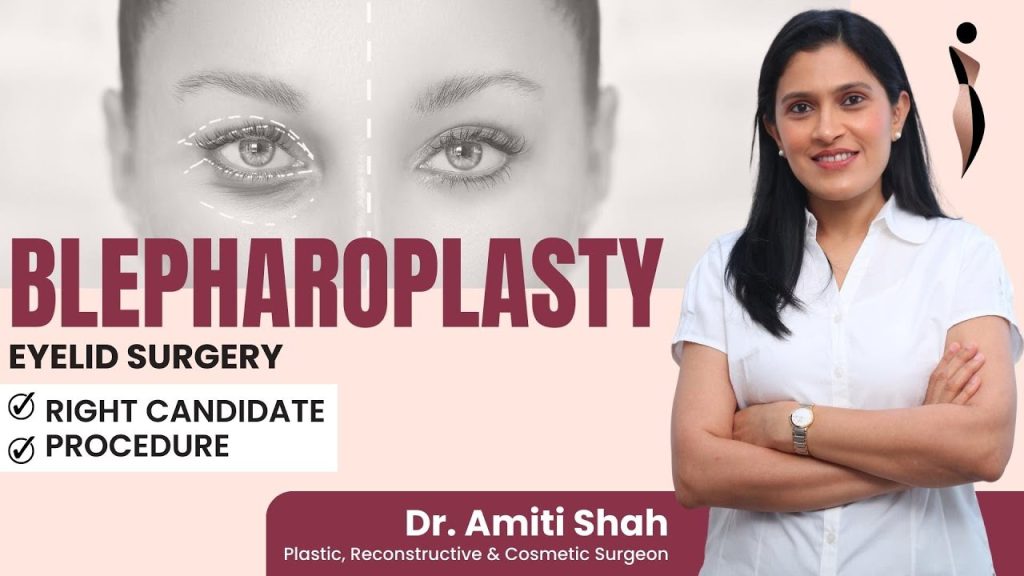 Blepharoplasty Meaning, Procedure & Are You A Good Candidate for Blepharoplasty Surgery?
