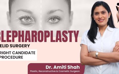 Blepharoplasty? Meaning, Procedure & Are You A Good Candidate for Blepharoplasty Surgery?