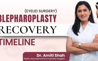 Eyelid Surgery Recovery | Blepharoplasty Recovery Timeline