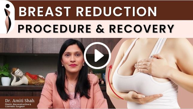 breast reduction procedure and recovery