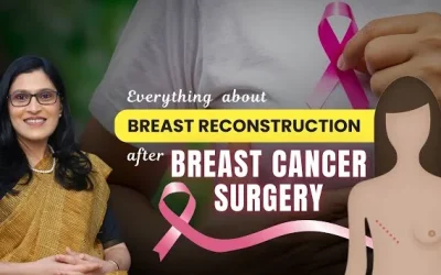 2 Ways of Breast Reconstruction after BREAST CANCER SURGERY