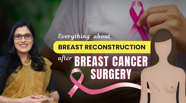 2 Ways of Breast Reconstruction after BREAST CANCER SURGERY