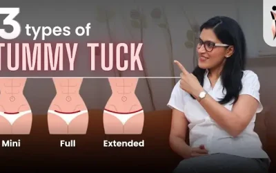 3 Types of TUMMY TUCK Incisions- Which is the BEST for You? 