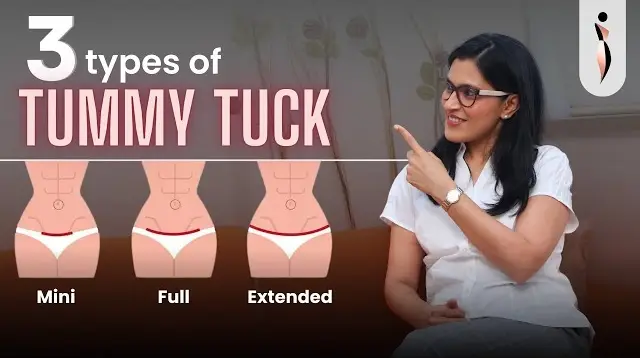 3 Types of TUMMY TUCK Incisions- Which is the BEST for You? 