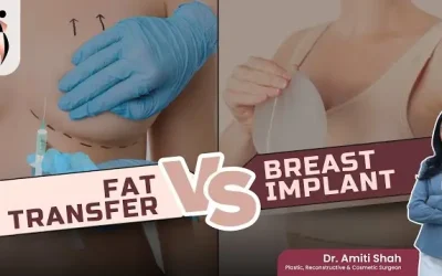 Breast Implants OR Fat Transfer- Which Is Better?