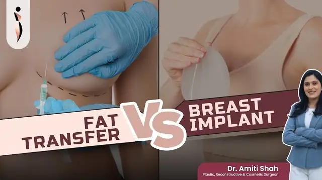 Breast Implants OR Fat Transfer- Which Is Better?