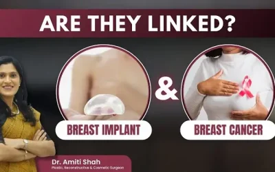 Do Breast Implants Cause Breast Cancer?