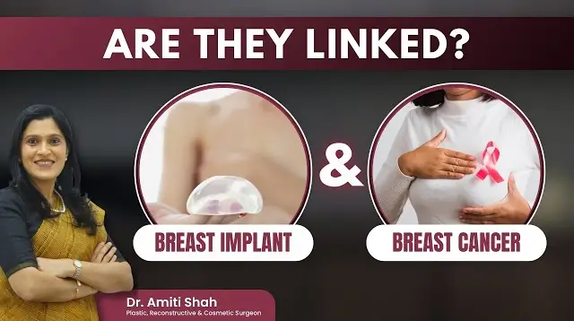 Do Breast Implants Cause Breast Cancer?