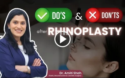 Rhinoplasty Care After Surgery | Dos and Don’ts After Rhinoplasty