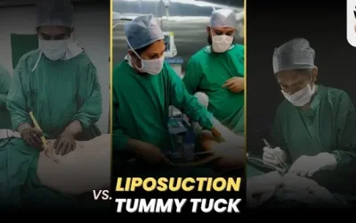 Tummy Tucks vs Liposuction: Which is Right for YOU?