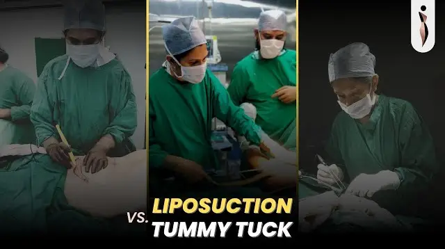 Tummy Tucks vs Liposuction: Which is Right for YOU?