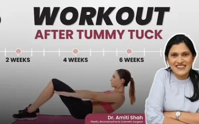 Exercises After the Tummy Tuck | Abdominoplasty Surgery Post Op Care