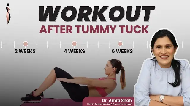 Exercises After the Tummy Tuck | Abdominoplasty Surgery Post Op Care