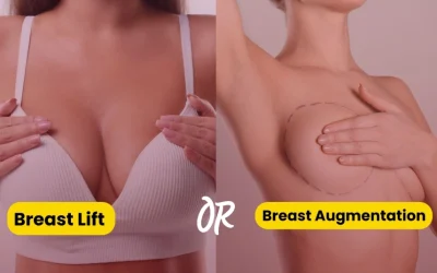 When is breast lift needed along with breast augmentation?