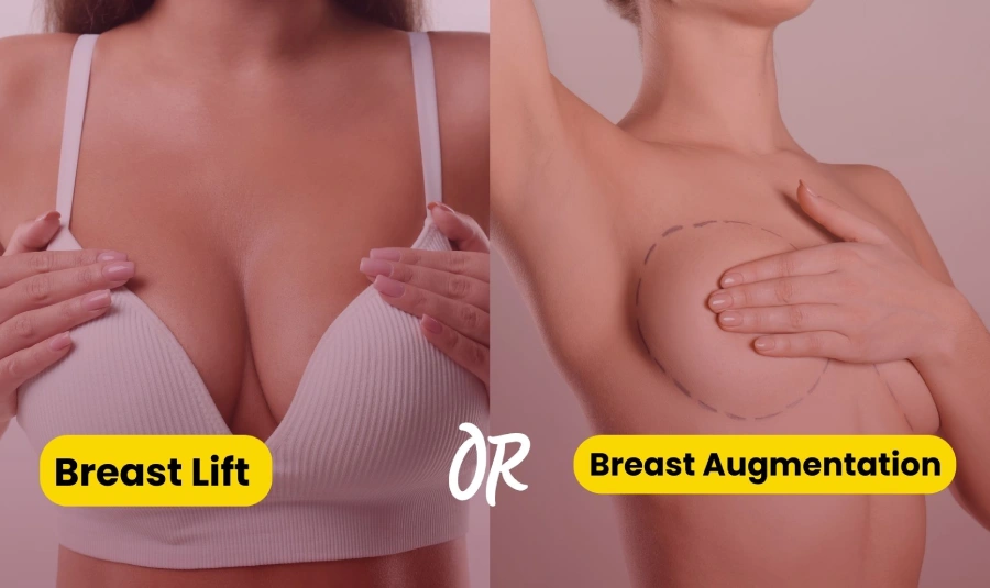 When is breast lift needed along with breast augmentation?