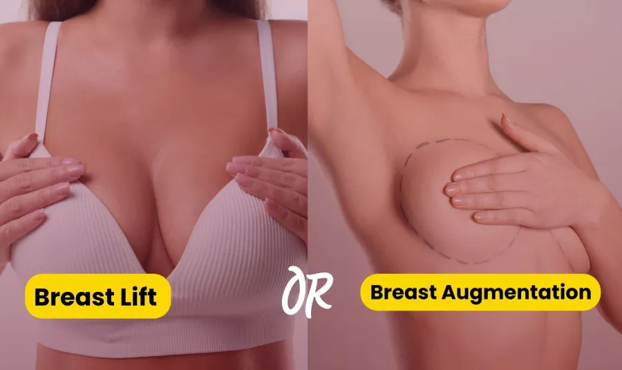 When is breast lift needed along with breast augmentation?